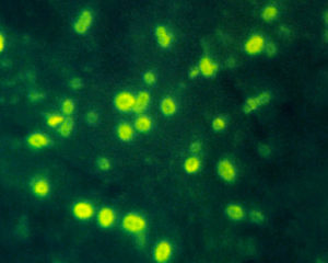 Hib (Haemophilus influenzae di tipo b)